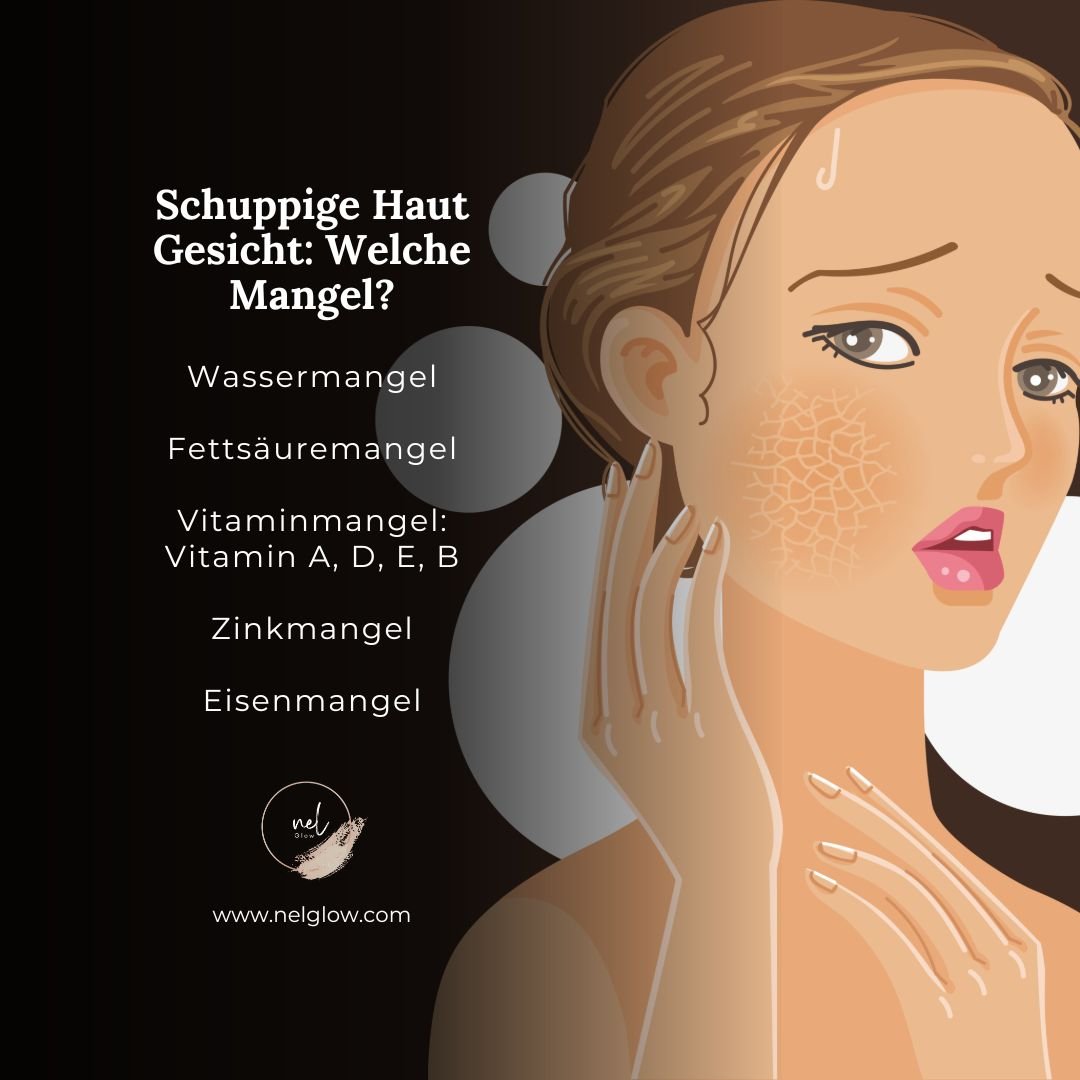 Warum du trockene, schuppige Haut hast und wie du sie loswirst — nelGlow